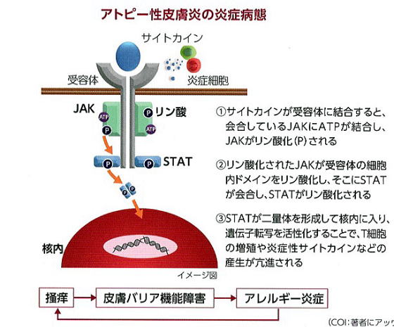 JAK阻害薬について